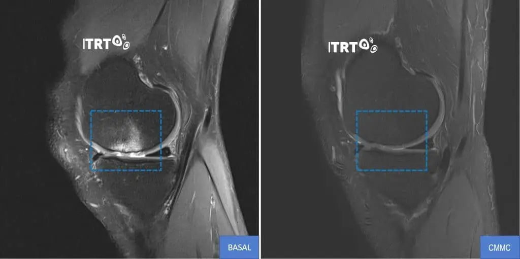 Regeneracion cartilago rodilla 2 2048x1022 1