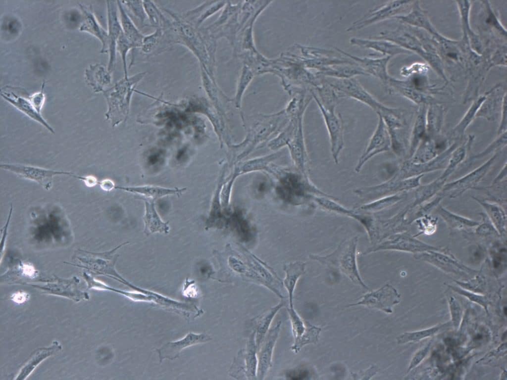cómo regenerar el tendón rotuliano con células mesenquimales