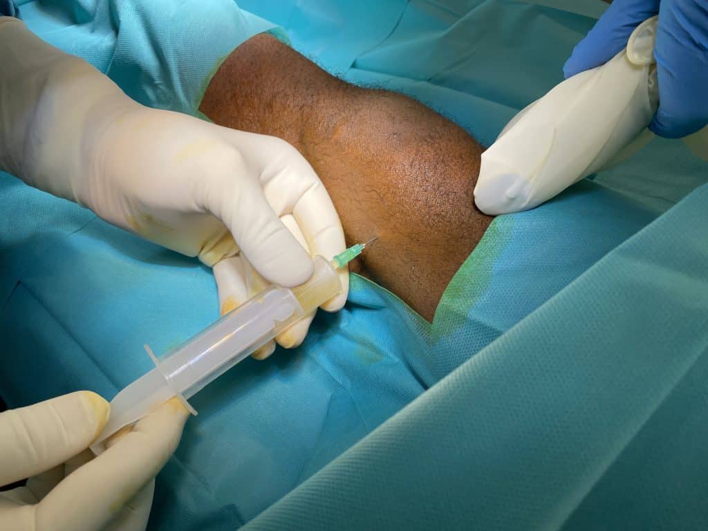 what are cultured mesenchymal cells and what are they used for?