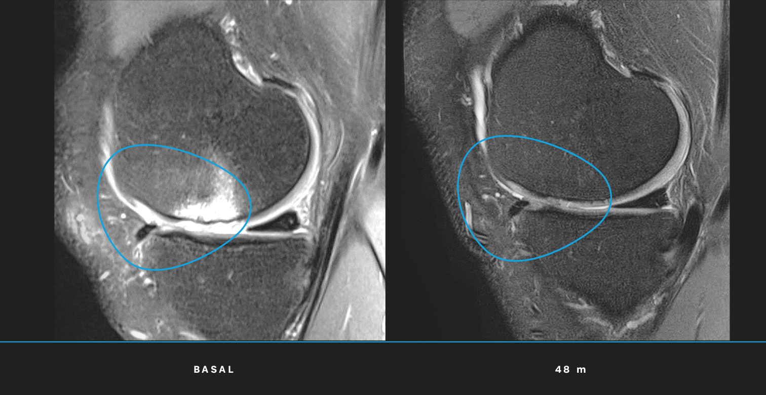 Our Exclusive Procedure 17 Magnetic resonance imaging follow-up