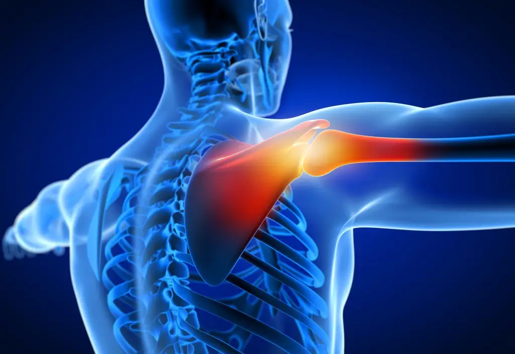 How to regenerate the supraspinatus tendon or rotator cuff